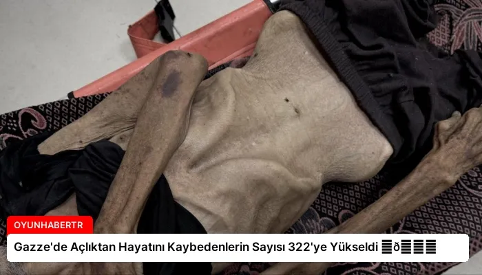 Gazze’de Açlıktan Hayatını Kaybedenlerin Sayısı 322’ye Yükseldi ⏬👇